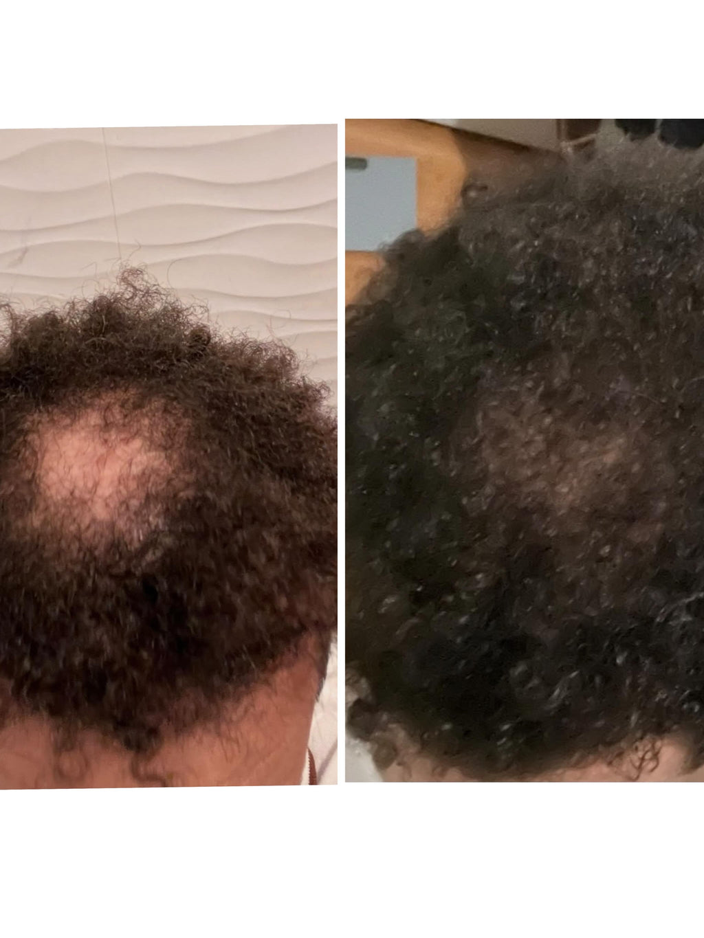 JMC Hair Co. Aceite de Romero para el Crecimiento del Cabello | Fortalece, Nutre y Favorece un Cabello Saludable